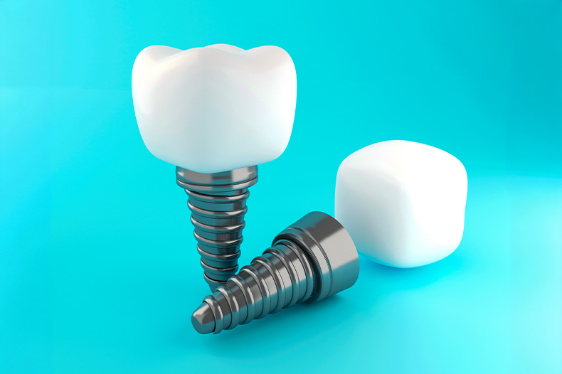 Implant Restoration